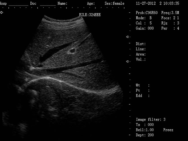 老式的b超機黑白要多少錢,新型B超機,B超機,黑白B超機