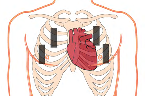 床旁超聲能檢查肺部嗎?